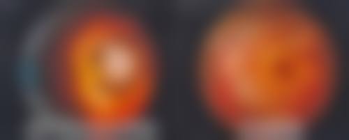 一、广州黄埔爱尔眼科医院有限公司怎么样？是专精的眼科诊疗专科医院