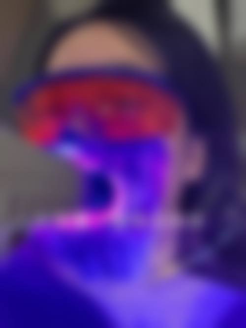 珠海冷光美白術前術後避坑指南（澳門生活習慣版）