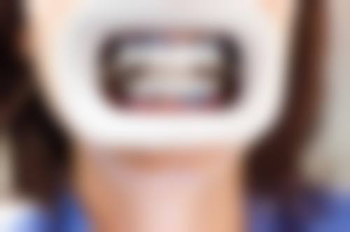 珠海冷光美白價錢 慳錢攻略：點樣預約更抵？
