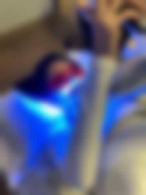 珠海冷光美白項目真相：澳門街坊更關心嘅3個問題