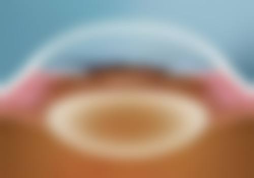 普瑞眼科集团主要开展哪些诊疗项目?