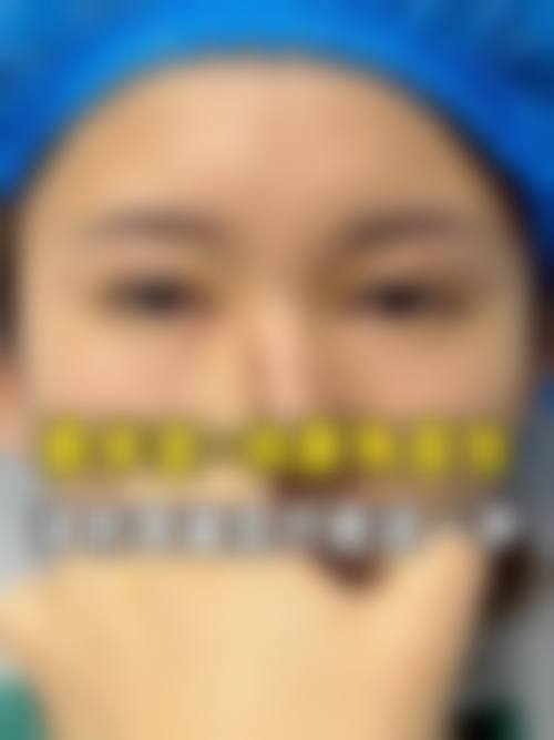 四、三等甲医师在线拆解去眼袋方案视频