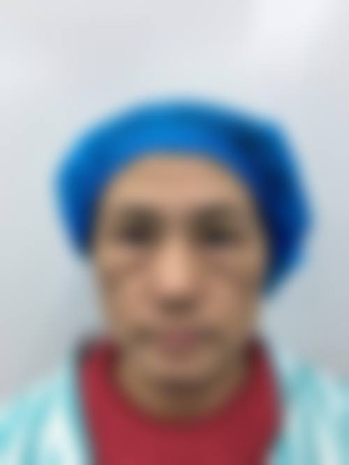 六、去眼袋手法视频中的日常护眼小叮嘱