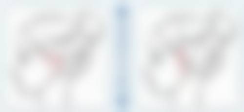 韓國JW鼻修復推薦 價錢大公開(HKD/MOP對比)