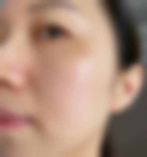 张晓雪医生口碑和评价