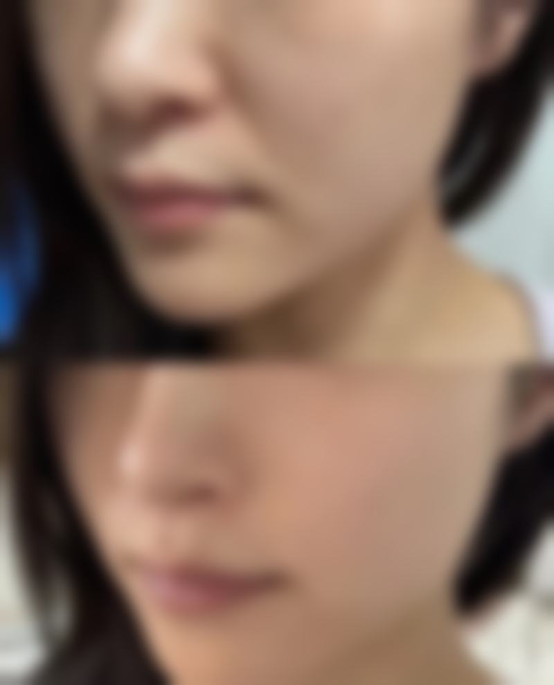 张晓雪医生怎么预约?