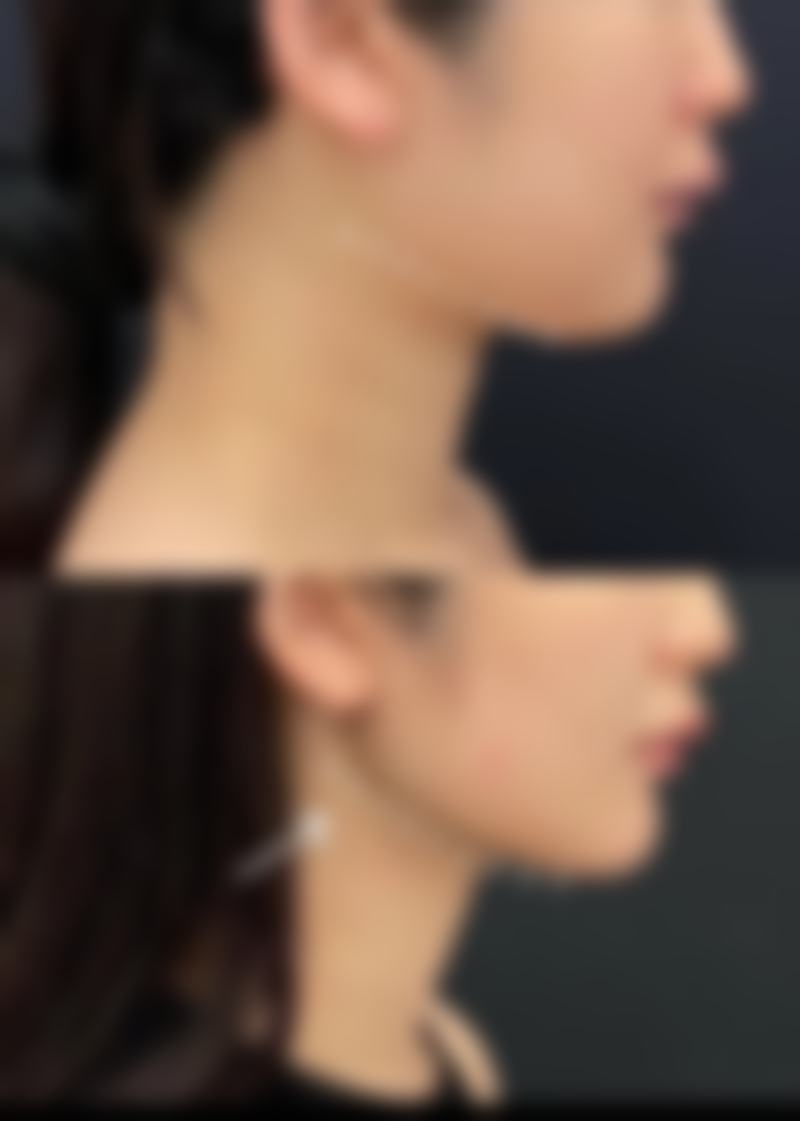 術前術後避坑指南:港澳姊妹必睇