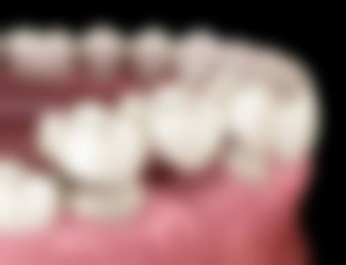 深圳瑞爾齒科箍牙推薦 2026收費價錢大公開(港幣/澳門幣對比)