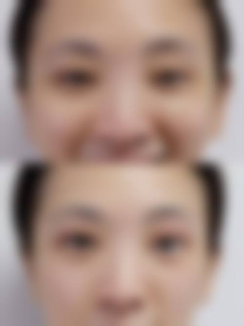 深圳市炫美医疗美容医院口碑如何