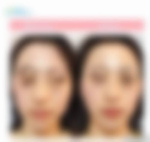 深圳市炫美医疗美容医院特色诊疗项目
