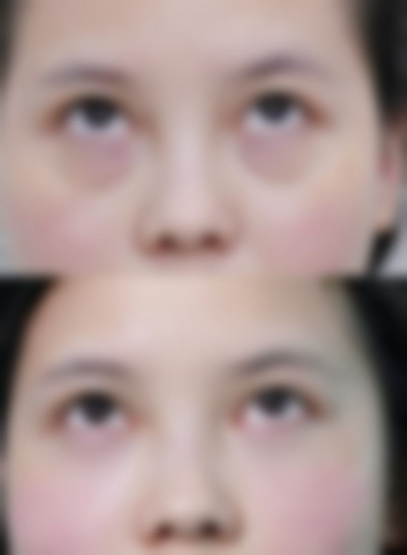 (1)眼科医生