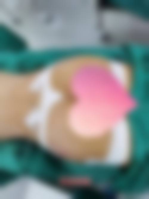 四、严若华医生的技术与典型操作流程