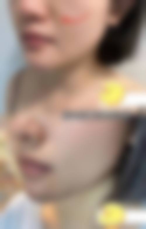 四川晶肤美容医院连锁温馨提示——为了节省您的时间,看诊前请预约哦!
