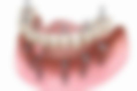 设备环境介绍:进口数字化设备,舒适诊疗环境