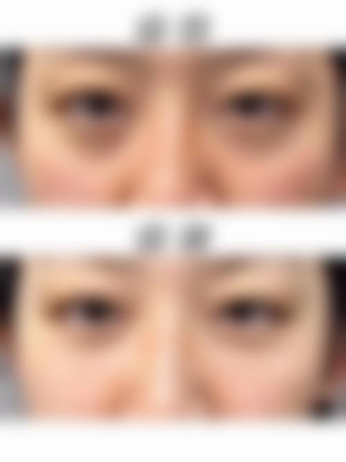 伤口状况如何影响洗脸时间?