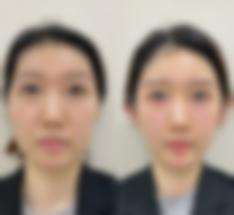 韓國tj整形醫院怎麼預約掛號 5步攻略(2026年全新)