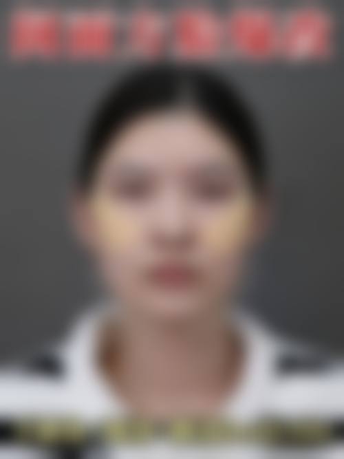 五、济南步步莲盛医疗美容诊所真实实例参考