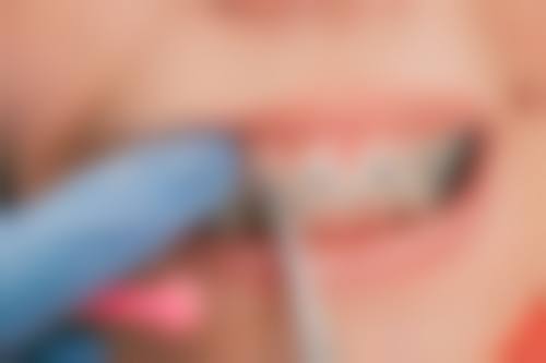 七、阜新王玮口腔诊疗项目