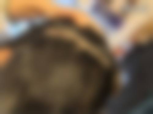 拓展延伸:港澳姊妹植髮常見問題解答