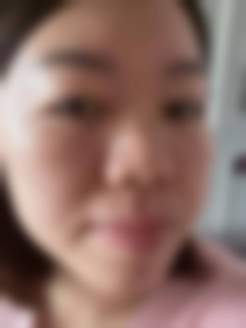 李明红医生手术成效