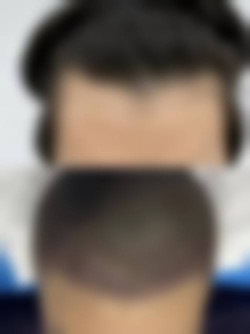 十一、珠海吉大郭闫伏整形医疗美容诊所真人口碑实例评价一览