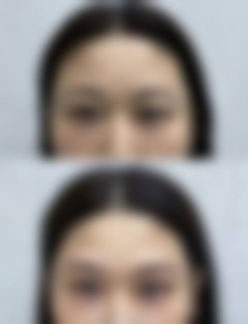 七、济南步步莲盛医疗美容诊所常见问题解答