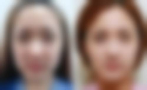 六、上海简自极医疗美容门诊部价格表
