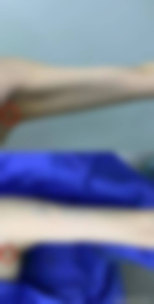 五、脸部吸脂安心吗 / 有哪些风险
