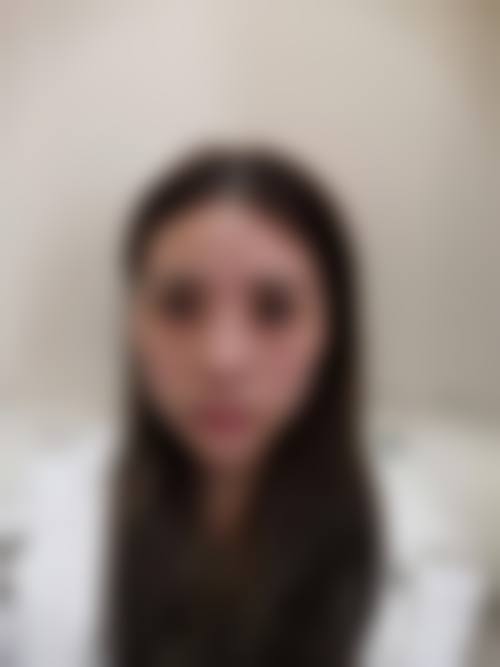 三、脸部吸脂多久完全修复