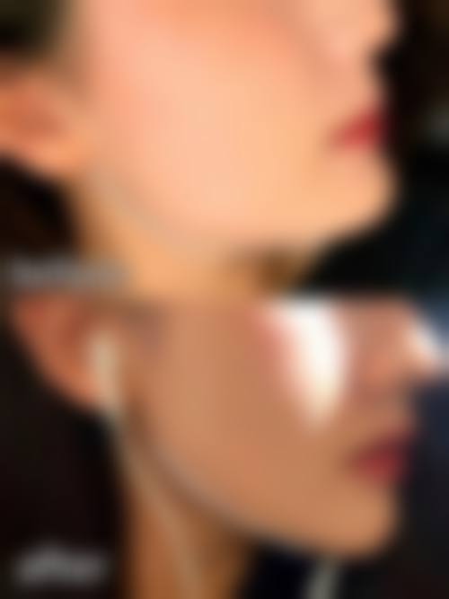 六、脸部吸脂价格一般多少