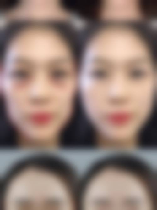 九、上海简自极医疗美容门诊部真人口碑实例评价一览