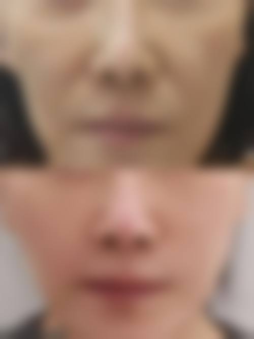 优惠活动详情