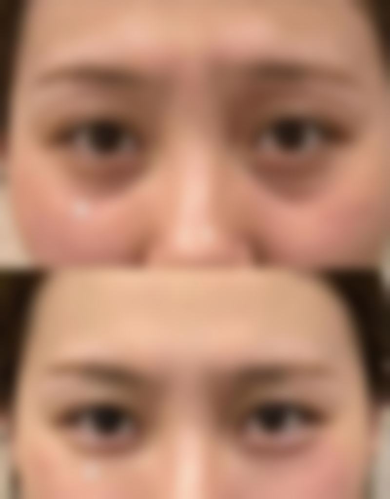 三、林秀敏医生技术水平高