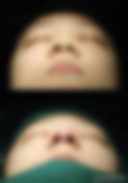 现在:修复中的观察