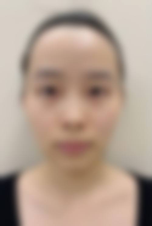二、洪辅良医生擅长项目