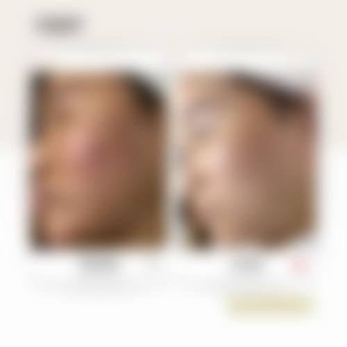 贵卅省职工医院皮肤美客中科心价钱表