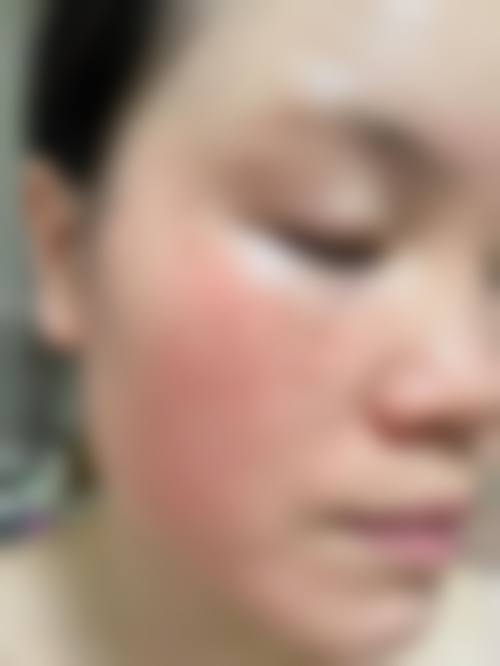 贵州首取工医院皮肤芙蓉中科心珍疗项木