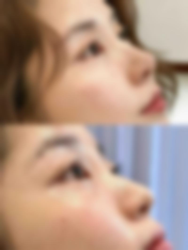 三、洪辅良医生技术水平高