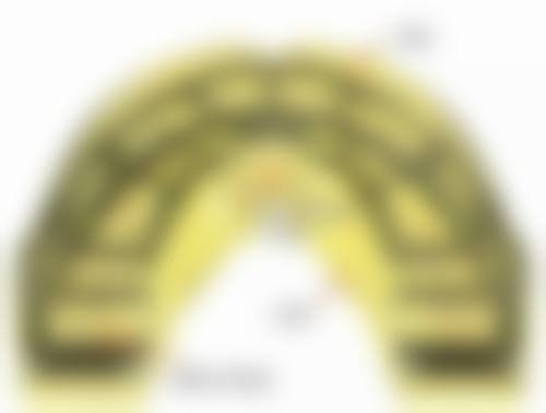 深圳牙齒矯正費用社保報銷?港澳保險點樣claim?