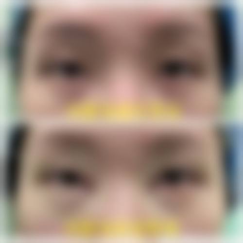 三、黄行医生技术水平高