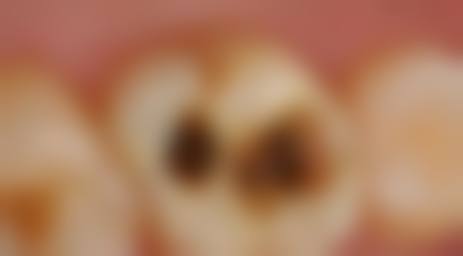 常见问题解答