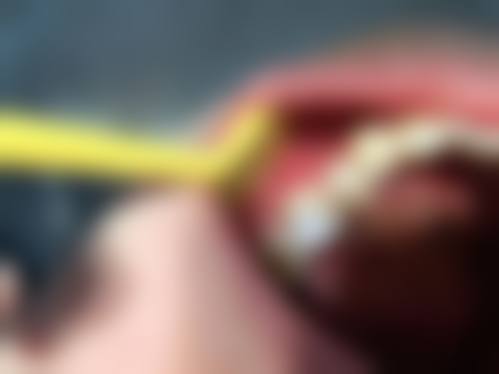 珠海牙科有冇多次付款 诊所拣选要点(澳门街坊必睇)