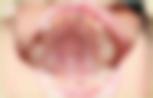 珠海牙科多次付款关键选择点(澳门街坊必记)