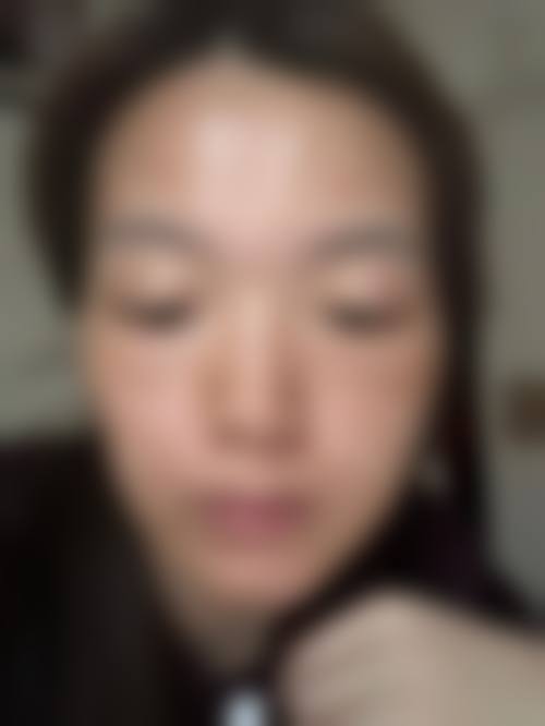 九、胡霜红医生患者常见就诊关注点说明