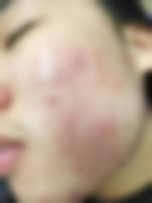 擅长项目详解