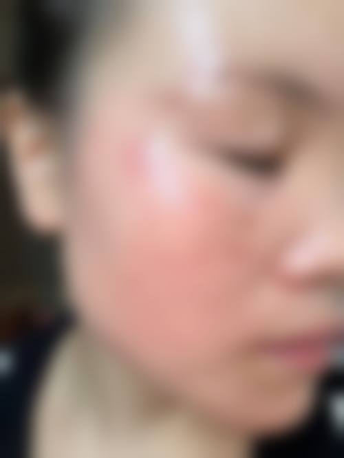 三、胡霜红医生技术水平高：