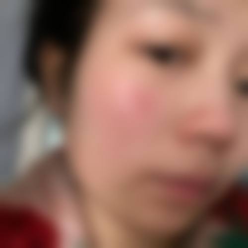 优惠活动详情:限时补贴助力美丽蜕变