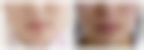 9、患者常见问题解答(精选 )