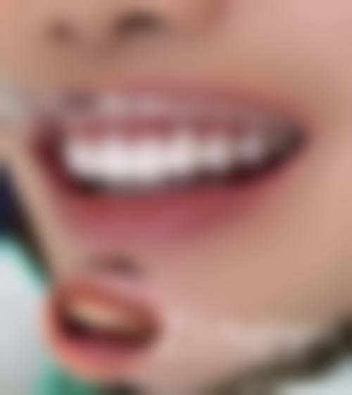 诊疗特色总结(黄江波 洛阳九龙口腔门诊部(八一店))