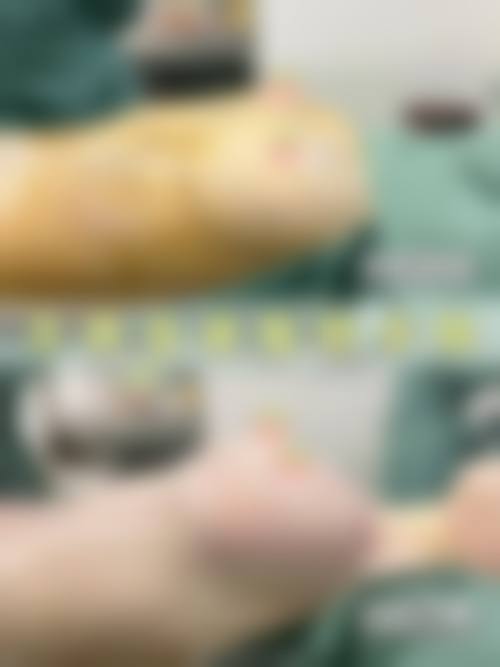 二、水动力隆胸成效如何